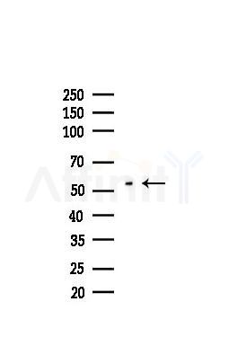 HLA-DPB1 Recombinant Rabbit mAb - Western blot analysis of lysates from COLO205 cells(heat-shock,45min treatment), using MHC Class II beta Recombinant Rabbit mAb at 1/1000 dilution.