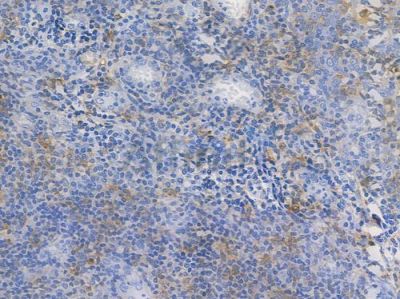 HLA-DPB1 Recombinant Rabbit mAb - BF3856 at 1/100 staining human normal tonsil tissue by IHC-P.
