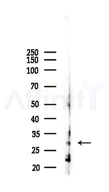 HLA-DPB1 Recombinant Rabbit mAb - Western blot analysis of lysates from Hela cells(LPS, 4h treatment), using MHC Class II Recombinant Rabbit mAb at 1/1000 dilution.