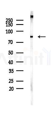 PFKM Recombinant Rabbit mAb - Western blot analysis of lysates from Rat muscle, using Fructose 6 Phosphate Kinase Recombinant Rabbit mAb at 1/1000 dilution.