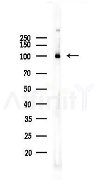 Hexokinase 1 Recombinant Rabbit mAb - Western blot analysis of lysates from Mouse brain, using Hexokinase 1 Rabbit mAb at 1/1000 dilution.