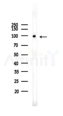 Hexokinase 1 Recombinant Rabbit mAb - Western blot analysis of lysates from HepG2 cells(heat-shock,45min treatment), using Hexokinase 1 Rabbit mAb at 1/1000 dilution.