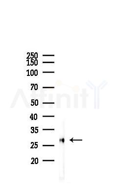 MPZ Recombinant Rabbit mAb - Western blot analysis of lysates from Mouse heart, using Myelin Protein Zero Recombinant Rabbit mAb at 1/1000 dilution.