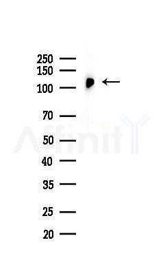 NAT10 Recombinant Rabbit mAb - Western blot analysis of lysates from EC304 cells(heat-shock,45min treatment), using NAT10 Recombinant Rabbit mAb at 1/1000 dilution.
