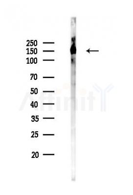 SRC3 Recombinant Rabbit mAb - Western blot analysis of lysates from B16F10-LUC cells(LPS,4h treatment), using SRC3 Recombinant Rabbit mAb at 1/1000 dilution.