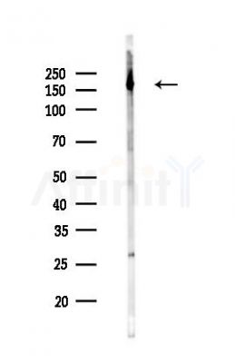 SRC3 Recombinant Rabbit mAb - Western blot analysis of lysates from Hela cells(LPS,4h treatment), using SRC3 Recombinant Rabbit mAb at 1/1000 dilution.