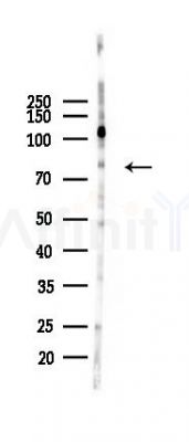 PKC beta 1 Recombinant Rabbit mAb - Western blot analysis of lysates from HUVEC cells(heat-shock 45min treatment), using PKC beta 1 Recombinant Rabbit mAb at 1/1000 dilution.