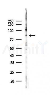 PKC beta 1 Recombinant Rabbit mAb - Western blot analysis of lysates from A2780 cells(LPS 4h treatment), using PKC beta 1 Recombinant Rabbit mAb at 1/1000 dilution.
