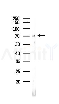 Plastin L Recombinant Rabbit mAb - Western blot analysis of lysates from Rat lung, using LCP1 Recombinant Rabbit mAb at 1/1000 dilution.