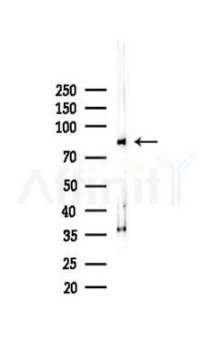 PFKP Recombinant Rabbit mAb - Western blot analysis of lysates from COLO205 cells(heat-shock,45min treatment), using PFKP Recombinant Rabbit mAb at 1/1000 dilution.