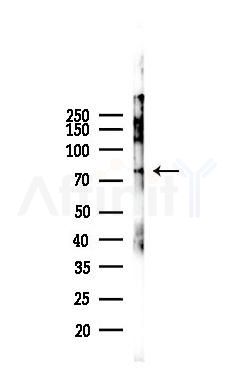 PFKP Recombinant Rabbit mAb - Western blot analysis of lysates from Mouse heart, using PFKP Recombinant Rabbit mAb at 1/1000 dilution.
