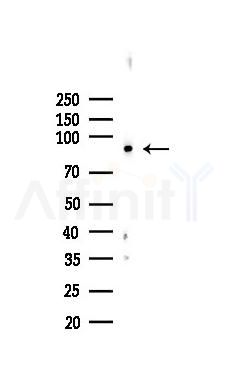 PFKP Recombinant Rabbit mAb - Western blot analysis of lysates from HUVEC cells(LPS,4h treatment), using PFKP Recombinant Rabbit mAb at 1/1000 dilution.