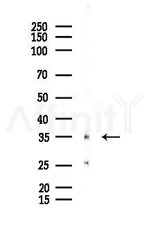 MAGB2 Antibody - Western blot analysis of lysates from EC304 cells(heat-shock 45min treatment), using MAGB2 Antibody at 1/1000 dilution.
