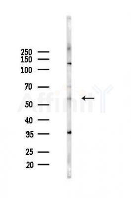 TRIM68 Antibody - Western blot analysis of lysates from 293 cells(starvation 24h treatment), using TRIM68 Antibody at 1/1000 dilution.