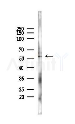 Cytochrome P450 2C9 Antibody - Western blot analysis of lysates from 293 cells(heat-shock 45min treatment), using Cytochrome P450 2C9 Antibody at 1/1000 dilution.