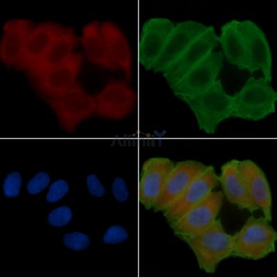 NRBP1 Antibody - DF10146 staining Hela cells(24h of starvation treatment) by IF/ICC.
