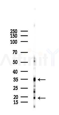 TNFRSF13C Antibody - Western blot analysis of lysates from EC304 cells(heat-shock 45min treatment), using TNFRSF13C Antibody at 1/1000 dilution.