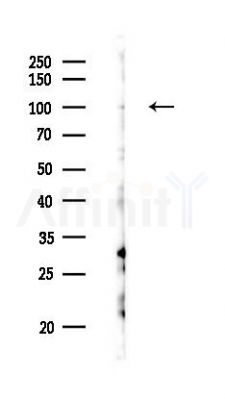 PSD4 Antibody - Western blot analysis of lysates from EC304 cells(UV 30min treatment), using PSD4 Antibody at 1/1000 dilution.