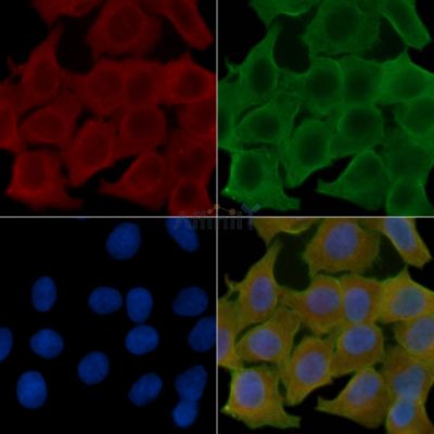 CCR10 Antibody - DF10204 staining Hela cells(24h of starvation treatment) by IF/ICC.