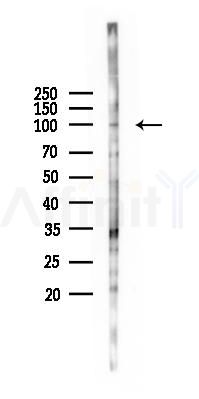GRM2 Antibody - Western blot analysis of lysates from HUVEC cells(starvation 24h treatment), using GRM2 Antibody at 1/1000 dilution.