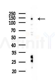 PASK Antibody - Western blot analysis of lysates from HUVEC cells(starvation 24h treatment), using PASK Antibody at 1/1000 dilution.