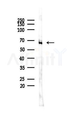 eIF2B epsilon Antibody - Western blot analysis of lysates from K562 cells(heat-shock 45min treatment), using eIF2B epsilon Antibody at 1/1000 dilution.