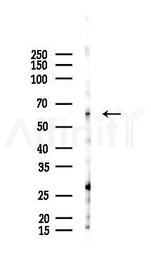 CRMP-1 Antibody - Western blot analysis of lysates from EC304 cells(heat-shock 45min treatment), using CRMP-1 Antibody at 1/1000 dilution.