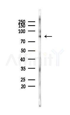 RSK2 Antibody - Western blot analysis of lysates from K562 cells(heat-shock 45min treatment), using RSK2 Antibody at 1/1000 dilution.