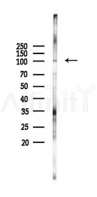 GADD34 Antibody - Western blot analysis of lysates from HUVEC cells(starvation 24h treatment), using GADD34 Antibody at 1/1000 dilution.