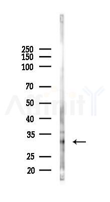 AIMP2/p38 Antibody - Western blot analysis of lysates from PC12 cells(LPS 4h treatment), using AIMP2/p38 Antibody at 1/1000 dilution.