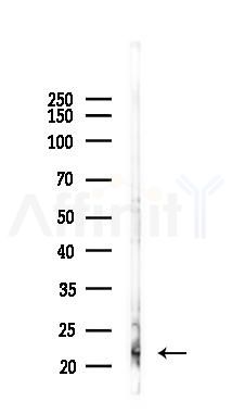 MPV17 Antibody - Western blot analysis of lysates from K562 cells(heat-shock 45min treatment), using MPV17 Antibody at 1/1000 dilution.
