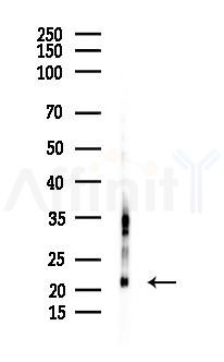 GPX7 Antibody - Western blot analysis of lysates from Rat lung, using GPX7 Antibody at 1/1000 dilution.
