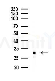 EXOSC3 Antibody - Western blot analysis of lysates from HUVEC cells(starvation 24h treatment), using EXOSC3 Antibody at 1/1000 dilution.