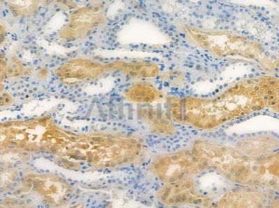 DOPA decarboxylase Antibody - DF12386 at 1/100 staining human normal kidney tissue by IHC-P.