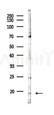 GMF-beta Antibody - Western blot analysis of lysates from K562 cells(UV 30min treatment), using GMF-beta Antibody at 1/1000 dilution.