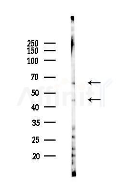 uPAR Antibody - Western blot analysis of lysates from HUVEC cells(heat-shock 45min treatment), using uPAR Antibody at 1/1000 dilution.