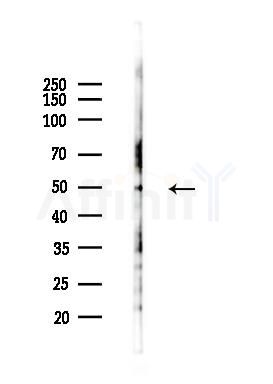 LIPL Antibody - Western blot analysis of lysates from HUVEC cells(heat-shock 45min treatment), using LIPL Antibody at 1/1000 dilution.