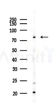 ARID3A Antibody - Western blot analysis of lysates from K562 cells(UV 30min treatment), using ARID3A Antibody at 1/1000 dilution.
