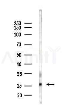 BNIP1 Antibody - Western blot analysis of lysates from K562 cells(UV 30min treatment), using BNIP1 Antibody at 1/1000 dilution.