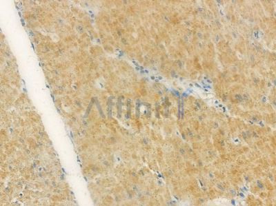 CORO1C Antibody - DF12586 at 1/100 staining human normal gastric tissue by IHC-P.