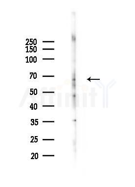 MPP3 Antibody - Western blot analysis of lysates from HUVEC cells(heat-shock 45min treatment), using MPP3 Antibody at 1/1000 dilution.