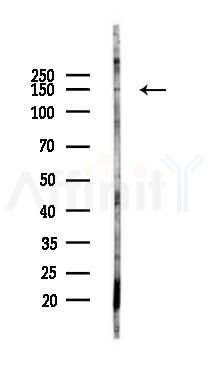 NKCC2 Antibody - Western blot analysis of lysates from Rat lung, using NKCC2 Antibody at 1/1000 dilution.