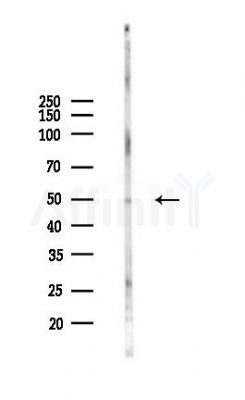 SLC11A2 Antibody - Western blot analysis of lysates from RAW264.