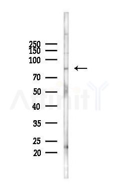 STIM2 Antibody - Western blot analysis of lysates from 293 cells(heat-shock 45min treatment), using STIM2 Antibody at 1/1000 dilution.