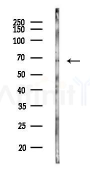 TH1L Antibody - Western blot analysis of lysates from K562 cells(UV 30min treatment), using TH1L Antibody at 1/1000 dilution.
