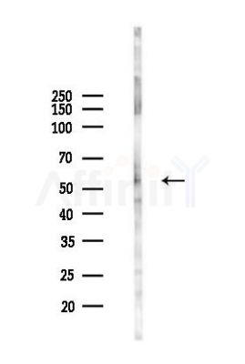 TRAF5 Antibody - Western blot analysis of lysates from RAW264.