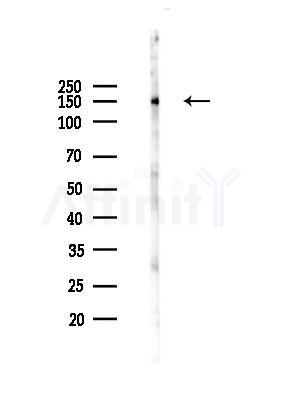 AHI1 Antibody - Western blot analysis of lysates from HUVEC cells(heat-shock 45min treatment), using AHI1 Antibody at 1/1000 dilution.