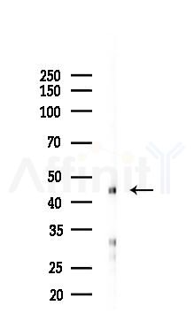 ALG1 Antibody - Western blot analysis of lysates from Hela cells(starvation 24h treatment), using ALG1 Antibody at 1/1000 dilution.