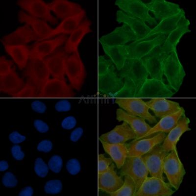 AP2B1 Antibody - DF12824 staining Hela cells(24h of starvation treatment) by IF/ICC.