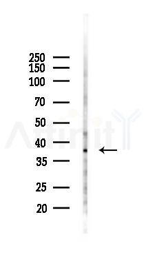 BCAT2 Antibody - Western blot analysis of lysates from K562 cells(UV 30min treatment), using BCAT2 Antibody at 1/1000 dilution.